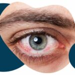 Managing Ocular Irritation in the Context of OECD Test Guideline 496